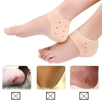 Silicone Heel Protectors for Cracked Heels (1 pair)