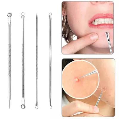 4pcs Blackhead Pimple Remover Tool Set