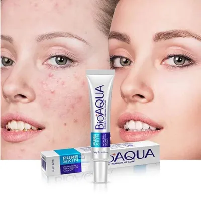 BIOAQUA Pure Skin AC*NE Removal Cream (30gm)