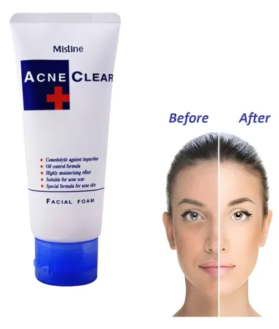 Mistine Acne Clear Facial Foam 85g